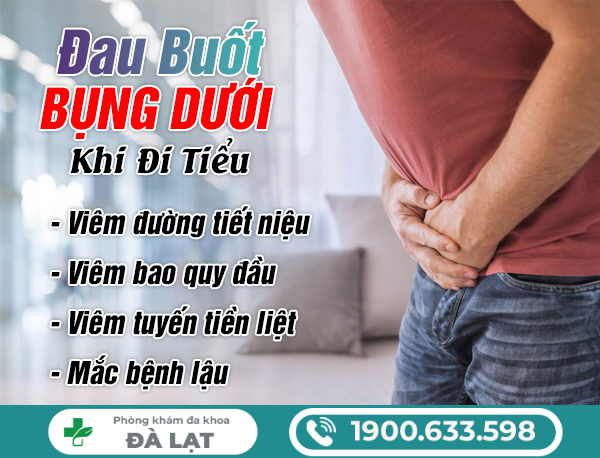 Hình ảnh minh họa